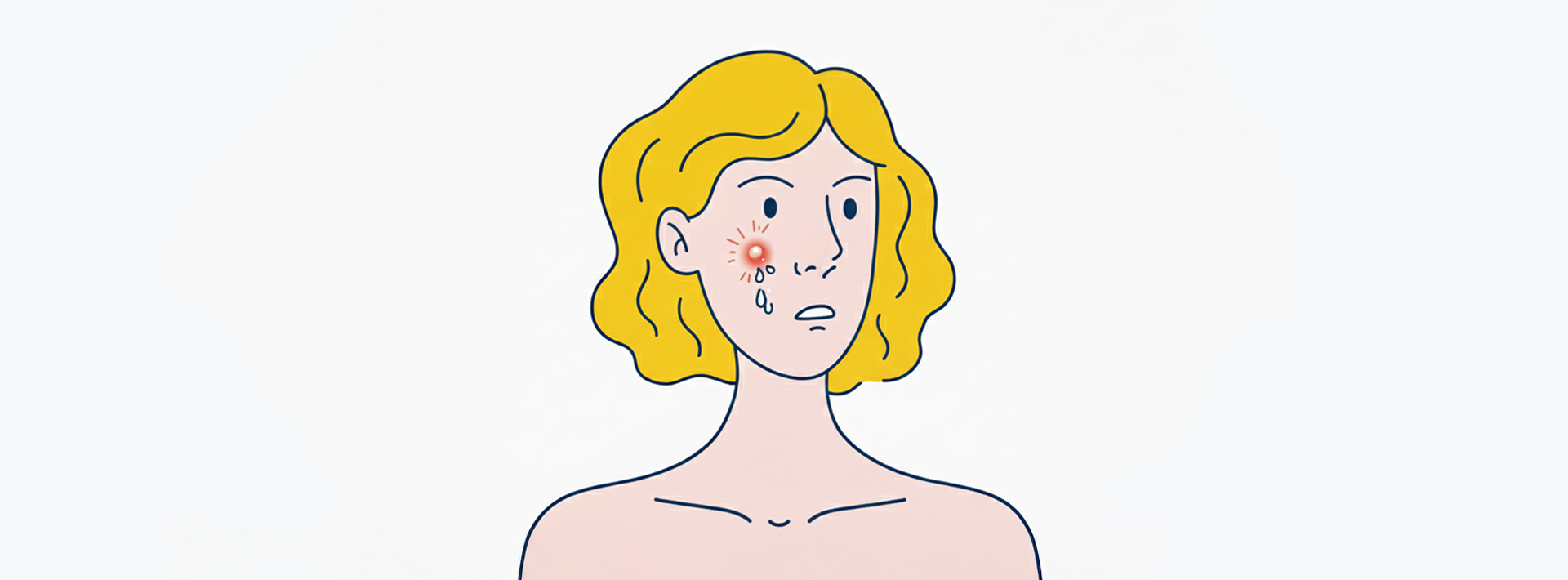 얼굴의 붉은 여드름 고민 때문에 속상해하는 여성 일러스트 배너